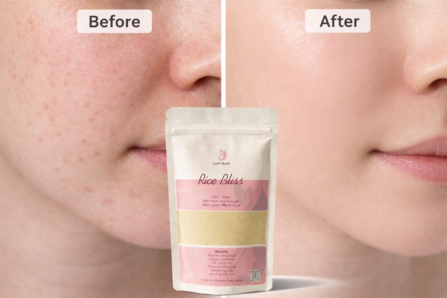 Rice Bliss | The ultimate nourishment for your skin